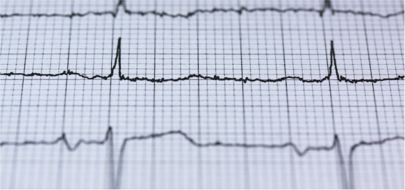 汽車(chē)金融高速增長(zhǎng) 融資租賃風(fēng)口開(kāi)啟_騰凱融資租賃